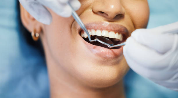 Best Emergency Dental Care for Abscessed Tooth in Chesapeake, VA